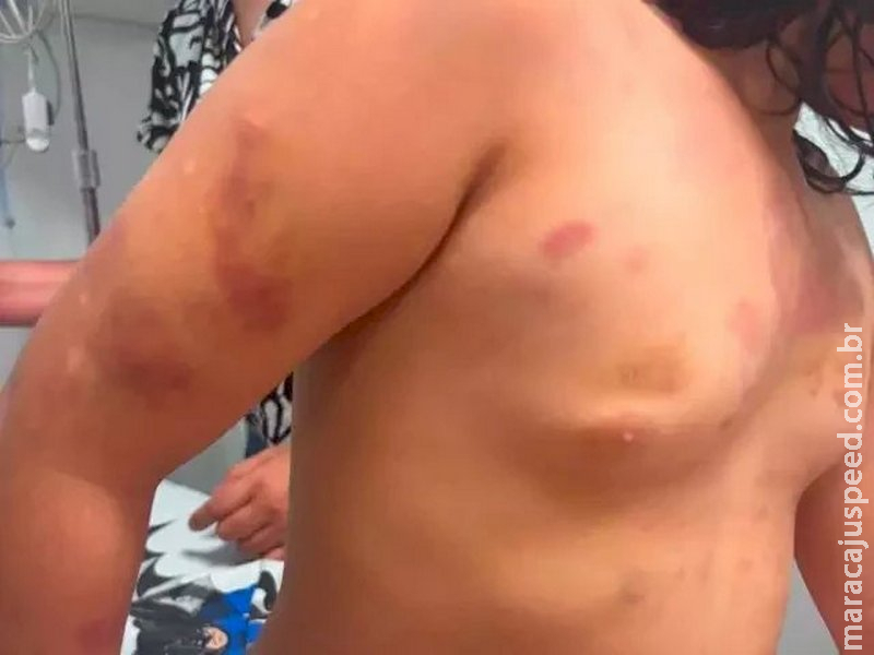 Menina brasileira é espancada pelo padrasto que acaba preso na fronteira