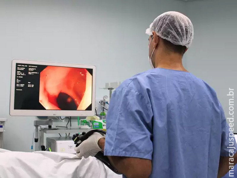Saúde aprova diretrizes para rastrear câncer de intestino no SUS